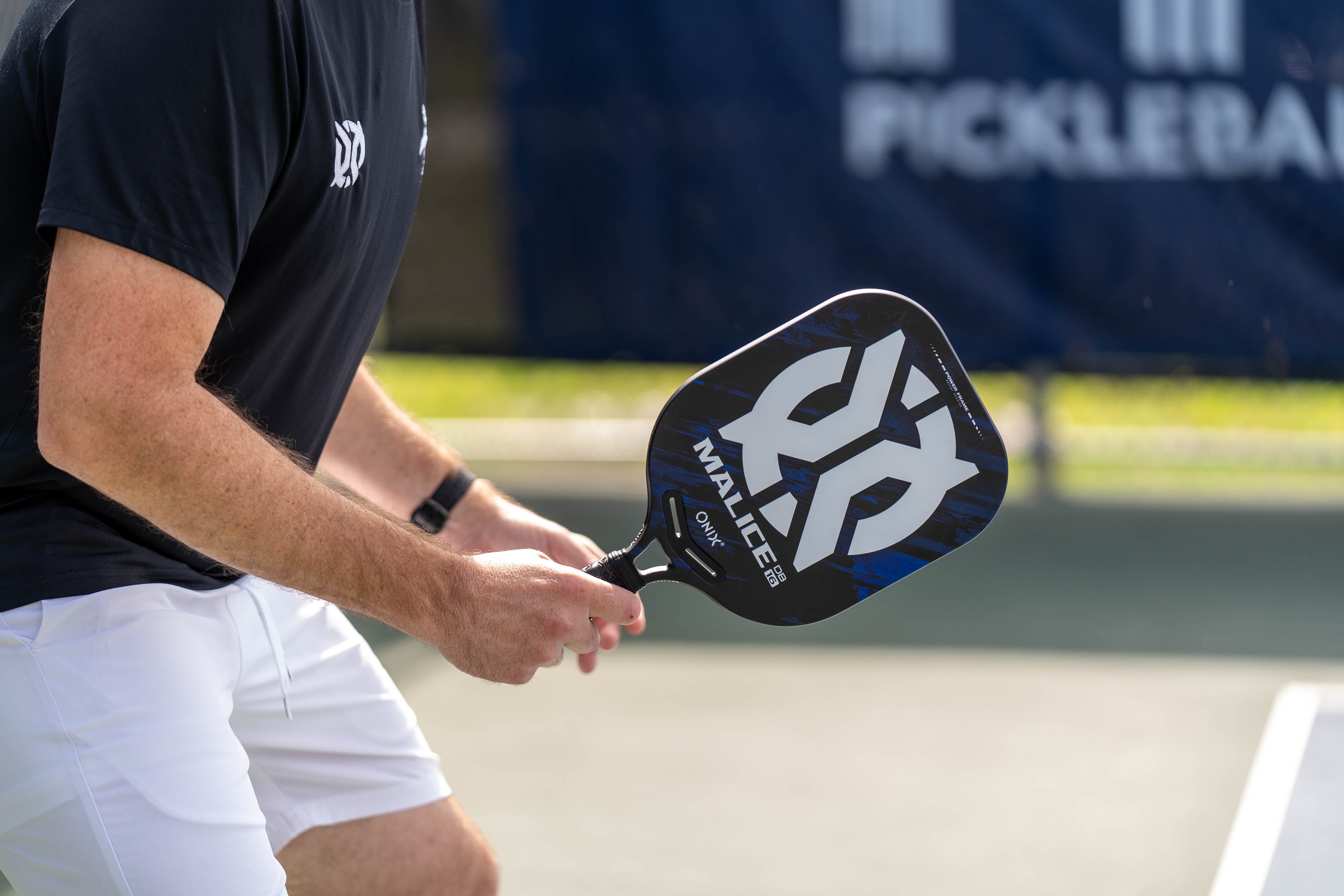 onix-malice-db-open-throat-racchetta-pickleball-composite-con-doppio-ponte-anti- image 4